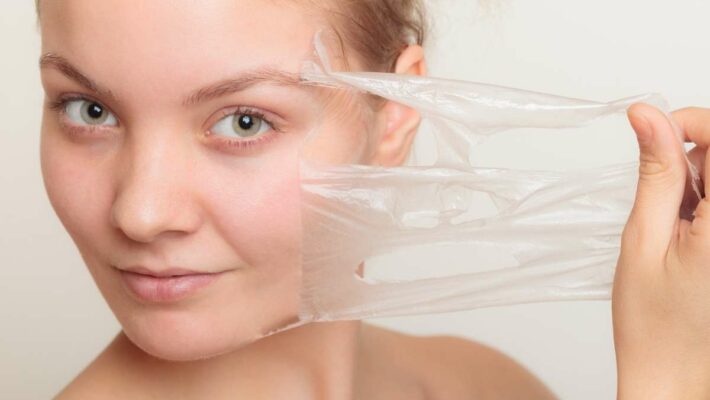 Chemical Skin Peels